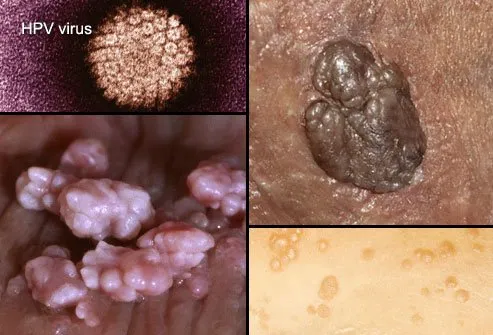 Penis on herpes signs early of