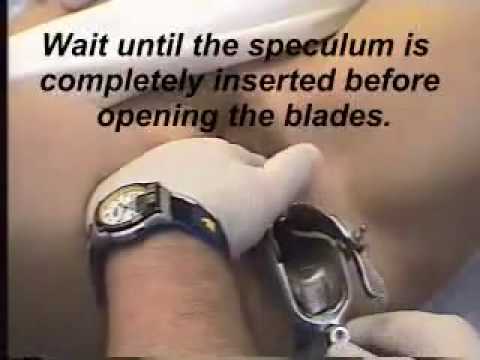 You tube pussy speculum pictures